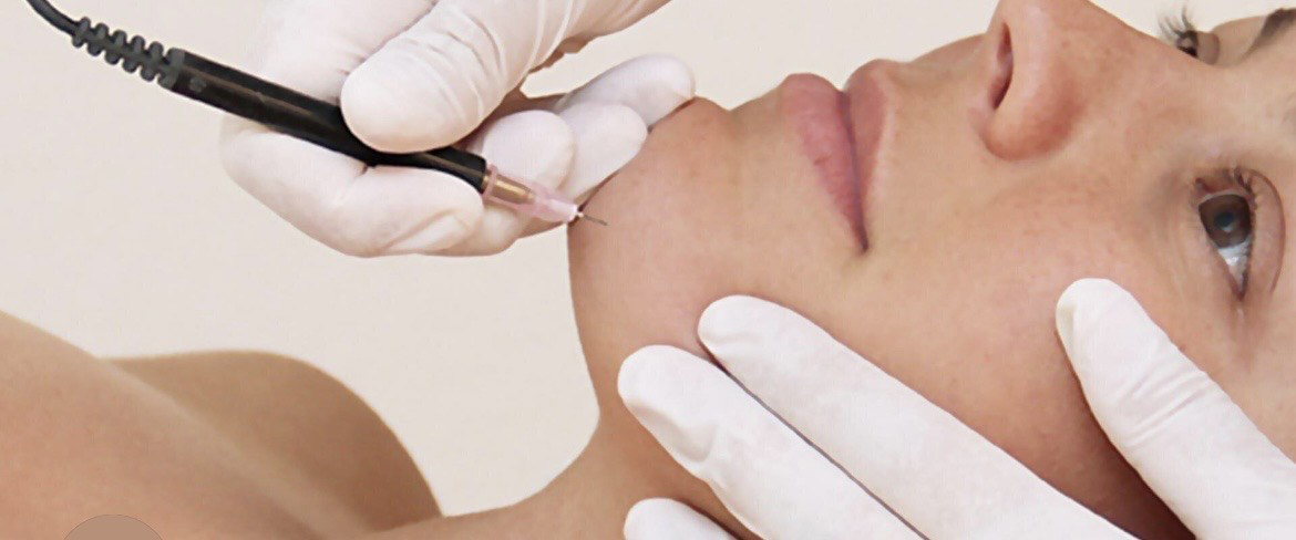Electrolysis Hair Removal